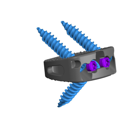 ANTENOR STAND ALONE ALIF CAGE